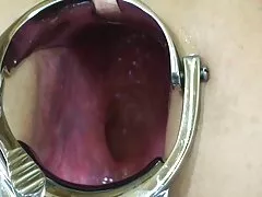 艾玛雪得到她的青少年猫，打击黑人男性
