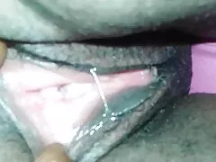 妨碍转移